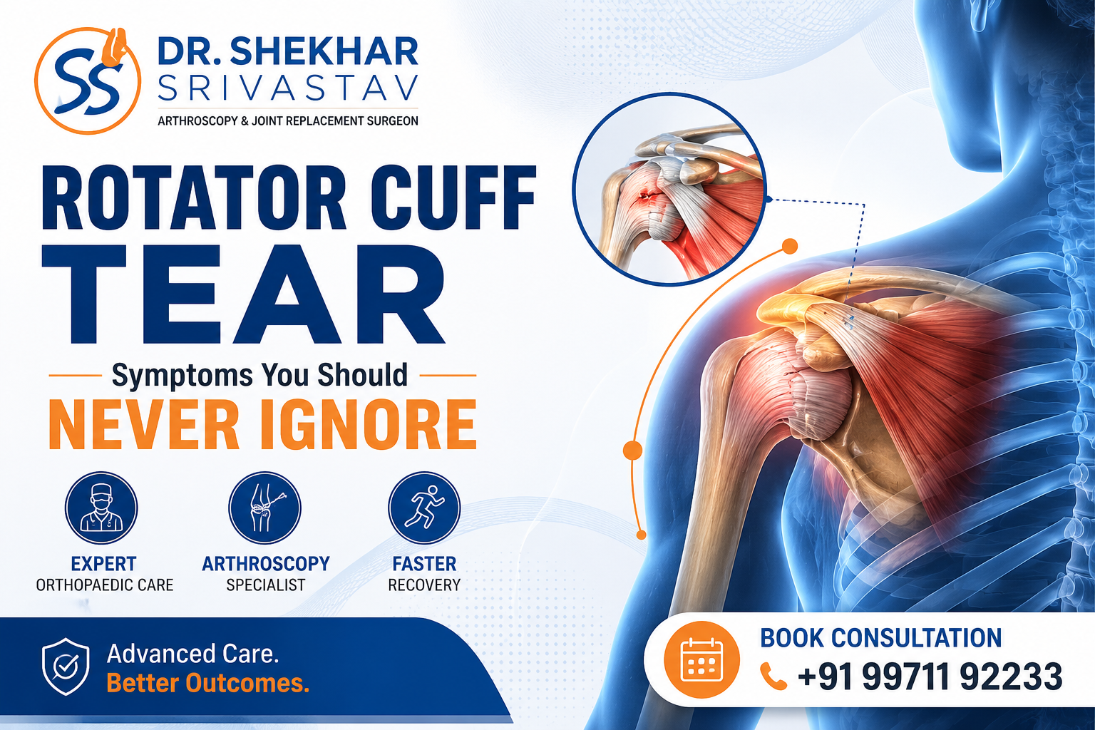 How to Heal a Rotator Cuff Tear Without Delaying Recovery