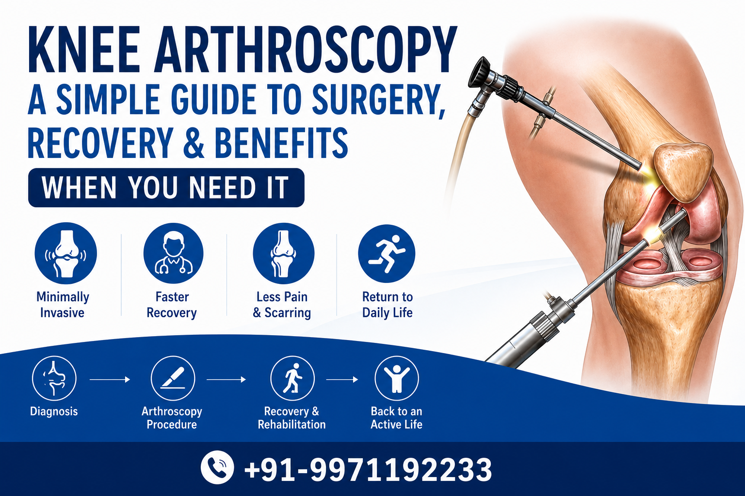 Knee Arthroscopy